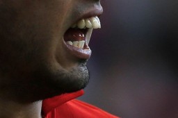 Suarezs-teeth.jpg